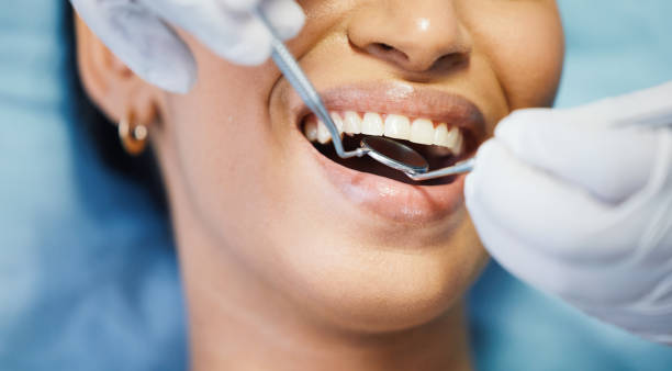 Best Emergency Wisdom Teeth Removal in Hillsdale, NJ